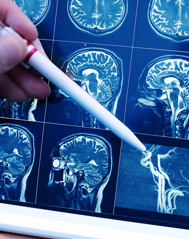 QN neuropsychiatry services landing page QN neuropsychiatry services landing page