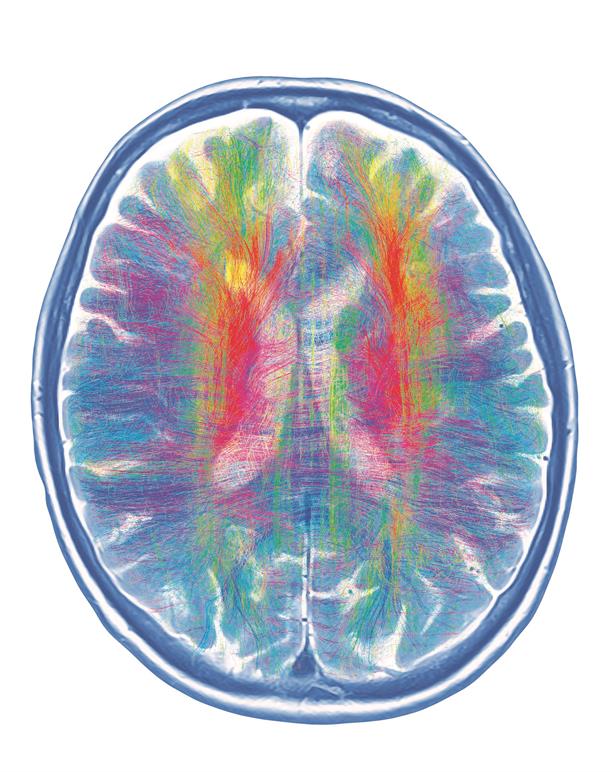 img12 Brain imagery